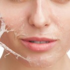 DOES CHEMICAL PEELING AFFECT THE SKIN image