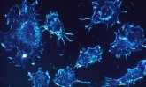 s300_cancer_cells_blue