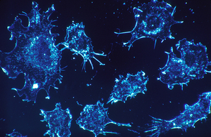 s300_cancer_cells_blue
