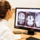 Female doctor analyzing MRI scan of the brain